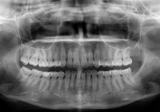 Diagnostyka obrazowa w stomatologii